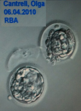 embryos_first_two